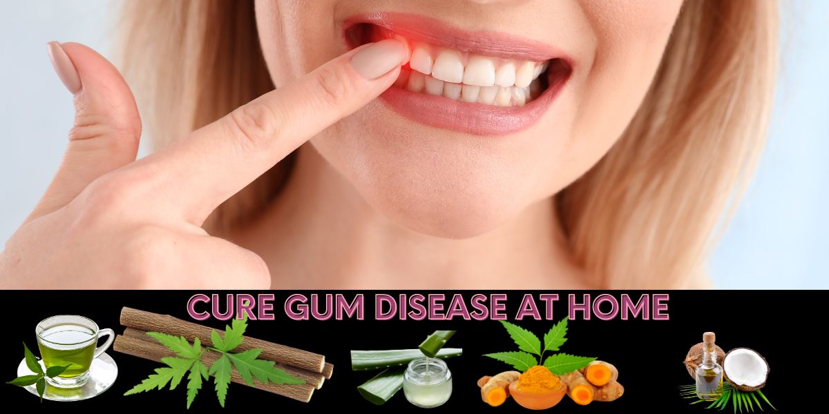 how to cure gum disease without a Dentist
